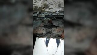 The hospital held a ditch toilet 1