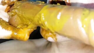 LOVE SCAT CATX - SCAT AND FLIP FLOPS