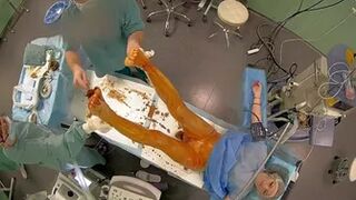 784_operation_2_cam_ch1_20210304200131_20210304201155