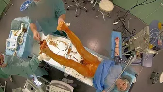 784_operation_2_cam_ch1_20210304200131_20210304201155