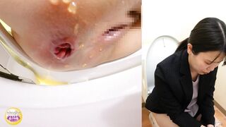 DLSL-665 07 Toilet next to the kitchenette: Constipated woman's farts are audible and defecated